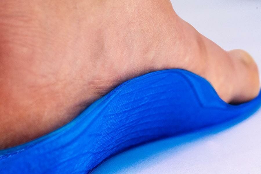Seitliche Nahaufnahme eines Fußes auf einer 3D gedruckten orthopädischen Einlage stehend. Mit Fokus auf das Längsgewölbe, das mit der Sohle gezielt unterstützt wird und genau der Fußform folgt.